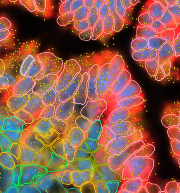 Xenium spatial transcriptomics fluorescence microscopy image showing subcellular RNA detection